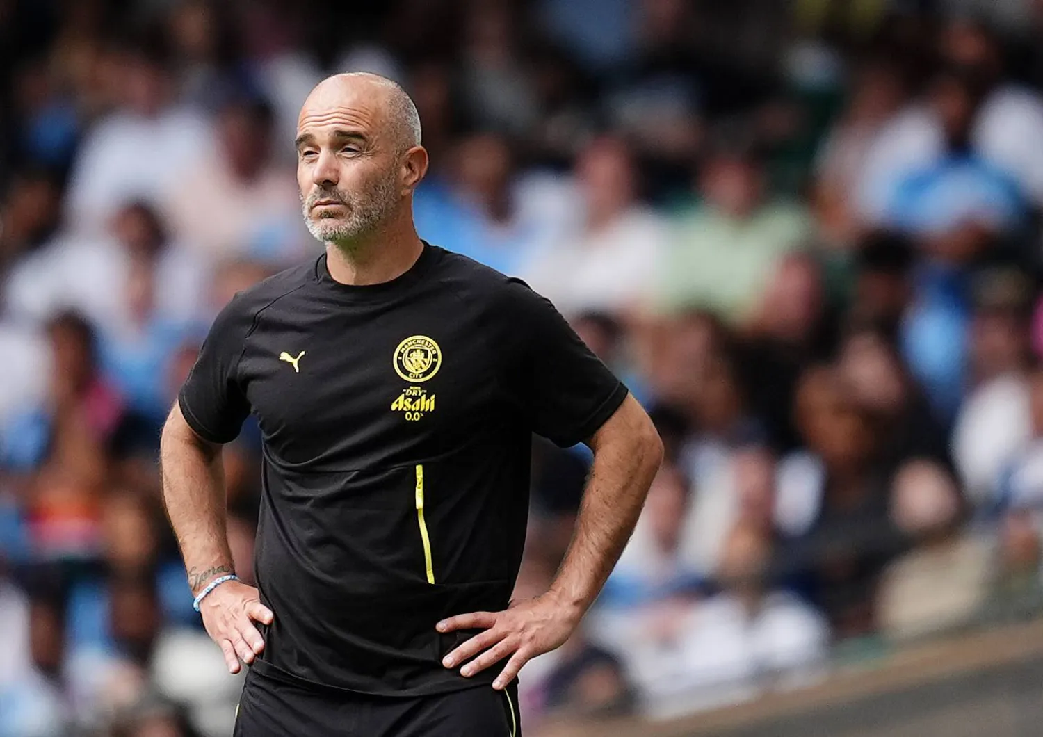 Turnover Pemain Manchester City: Ujian Berat Enzo Maresca
